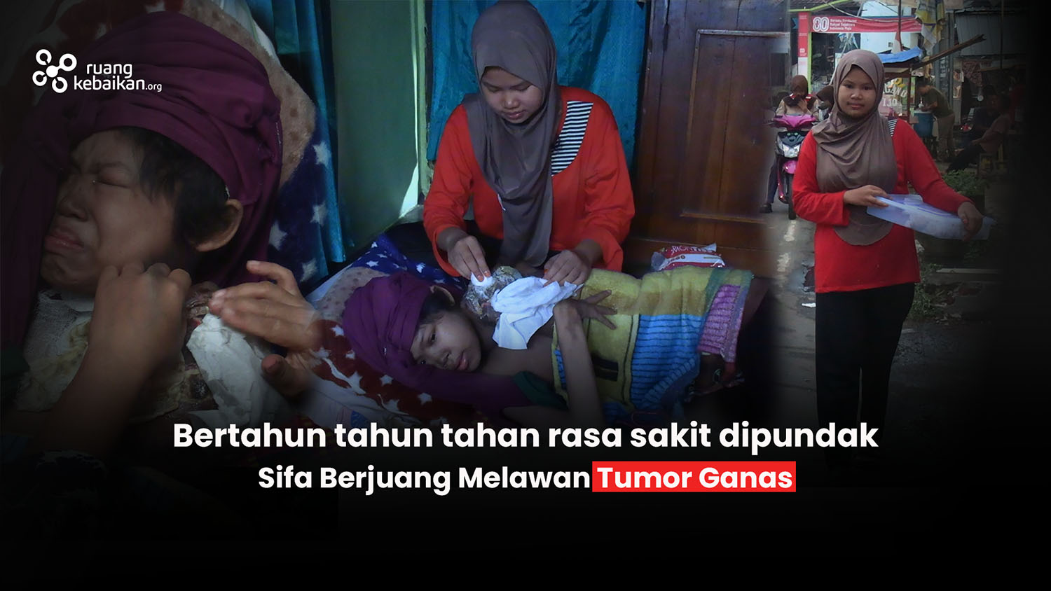 Tumor Ganas Menyerang Sifa Hingga Tangan Harus Diamputasi