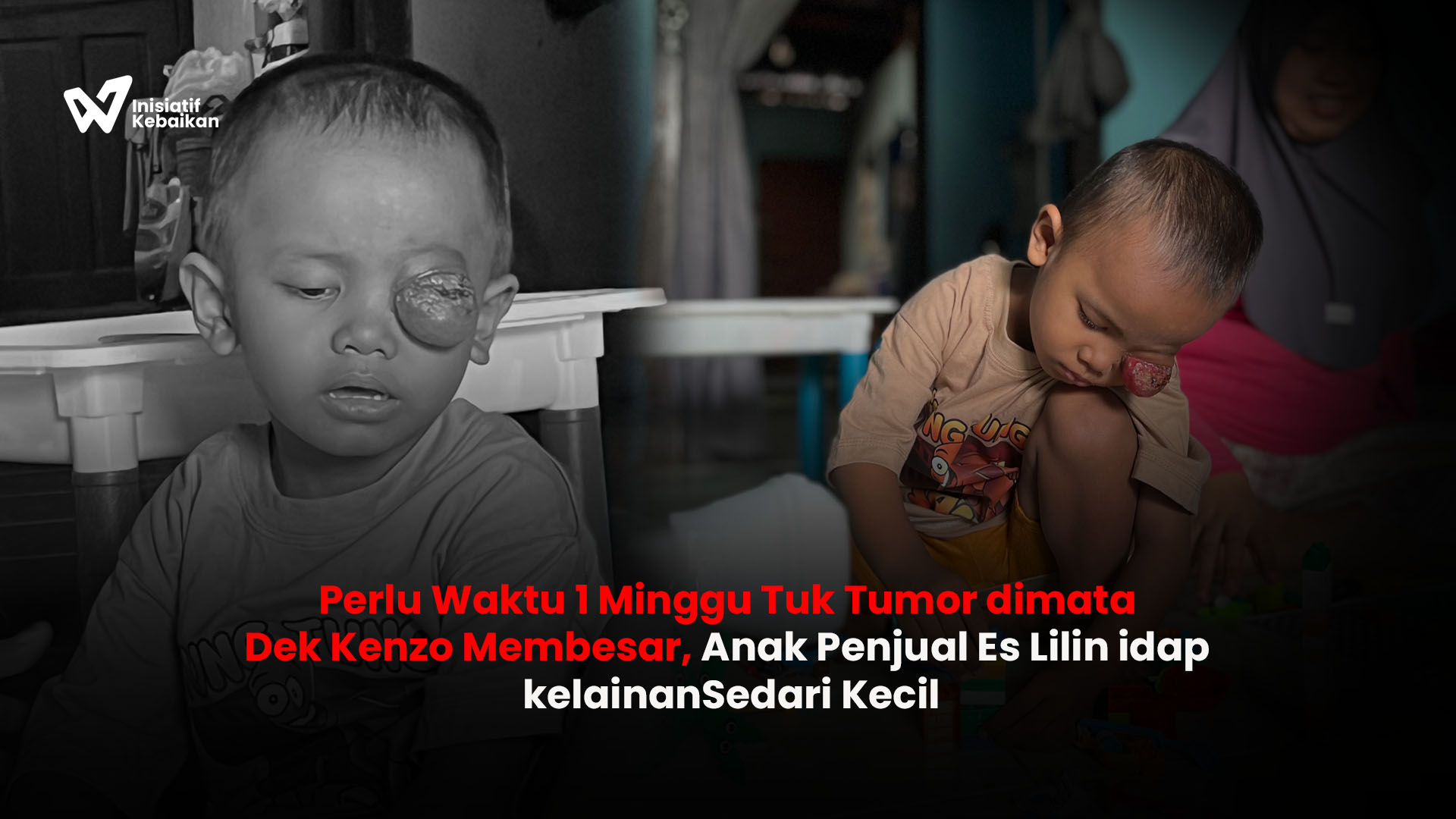 Tolong! Anak Penjual Es Lilin ini Harus Segera di Operasi